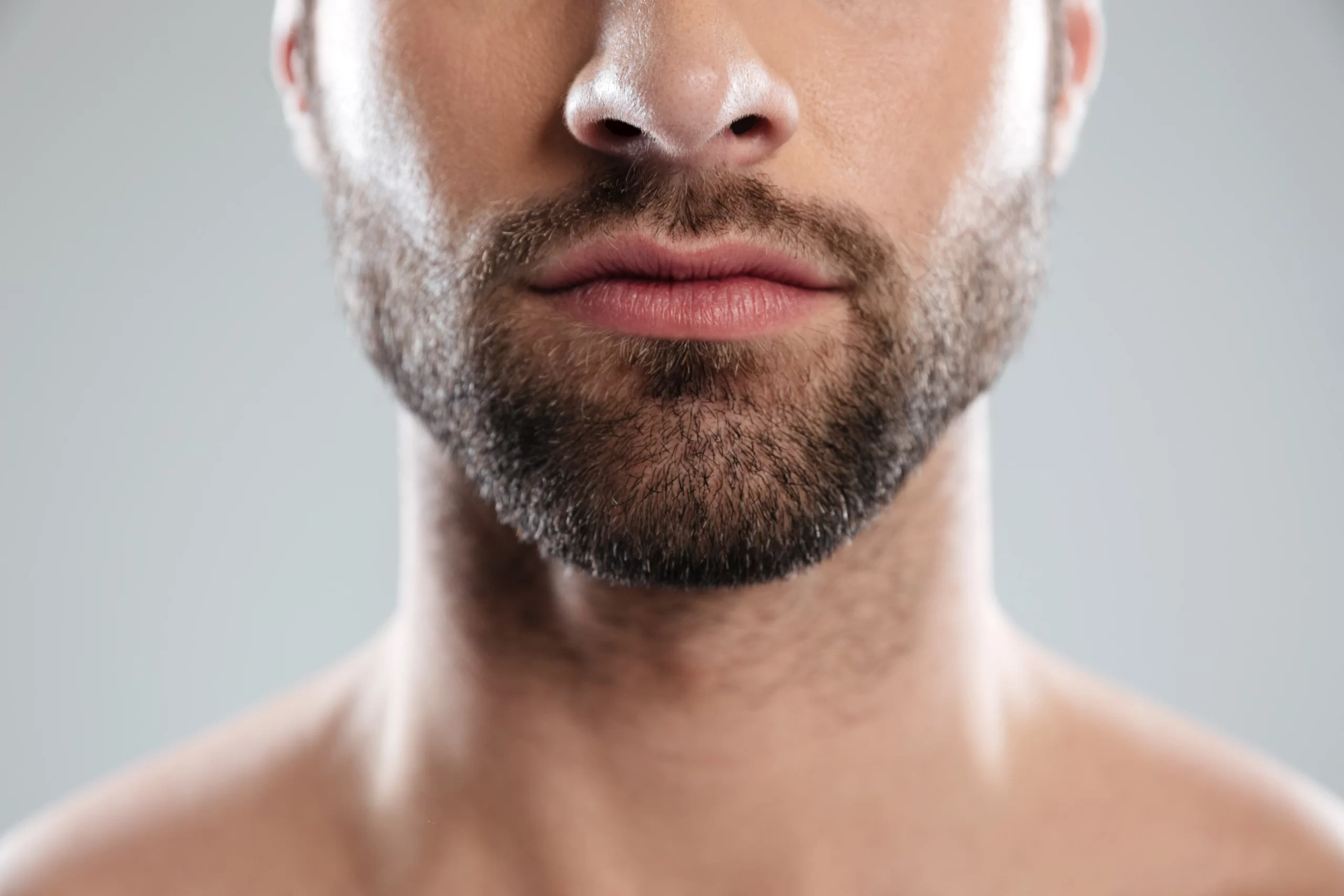 transplante-de-barba